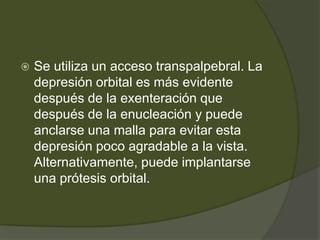  Se utiliza un acceso transpalpebral. La
depresión orbital es más evidente
después de la exenteración que
después de la enucleación y puede
anclarse una malla para evitar esta
depresión poco agradable a la vista.
Alternativamente, puede implantarse
una prótesis orbital.
 