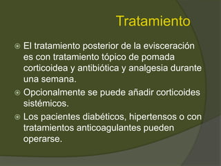 Tratamiento
 El tratamiento posterior de la evisceración
es con tratamiento tópico de pomada
corticoidea y antibiótica y analgesia durante
una semana.
 Opcionalmente se puede añadir corticoides
sistémicos.
 Los pacientes diabéticos, hipertensos o con
tratamientos anticoagulantes pueden
operarse.
 