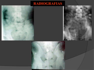RADIOGRAFIAS
 