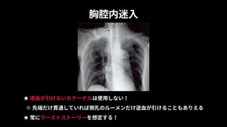 胸腔内迷⼊
★ 逆⾎が引けないカテーテルは使⽤しない！
※ 先端だけ貫通していれば側孔のルーメンだけ逆⾎が引けることもありえる
★ 常にワーストストーリーを想定する！
 