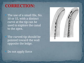 procedural errors diagnosis and treatment | PPT