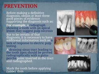 procedural errors diagnosis and treatment | PPT