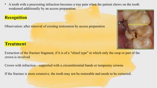Infraction Tooth Procedural Errors in Endodontics: Prevention & Management | PPTX