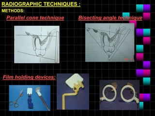 procedural errors in endodontics ppt.ppt
