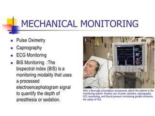 MECHANICAL MONITORING
 Pulse Oximetry
 Capnography
 ECG Monitoring
 BIS Monitoring :The
bispectral index (BIS) is a
monitoring modality that uses
a processed
electroencephalogram signal
to quantify the depth of
anesthesia or sedation.
 