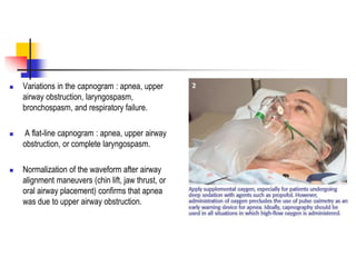  Variations in the capnogram : apnea, upper
airway obstruction, laryngospasm,
bronchospasm, and respiratory failure.
 A flat-line capnogram : apnea, upper airway
obstruction, or complete laryngospasm.
 Normalization of the waveform after airway
alignment maneuvers (chin lift, jaw thrust, or
oral airway placement) confirms that apnea
was due to upper airway obstruction.
 
