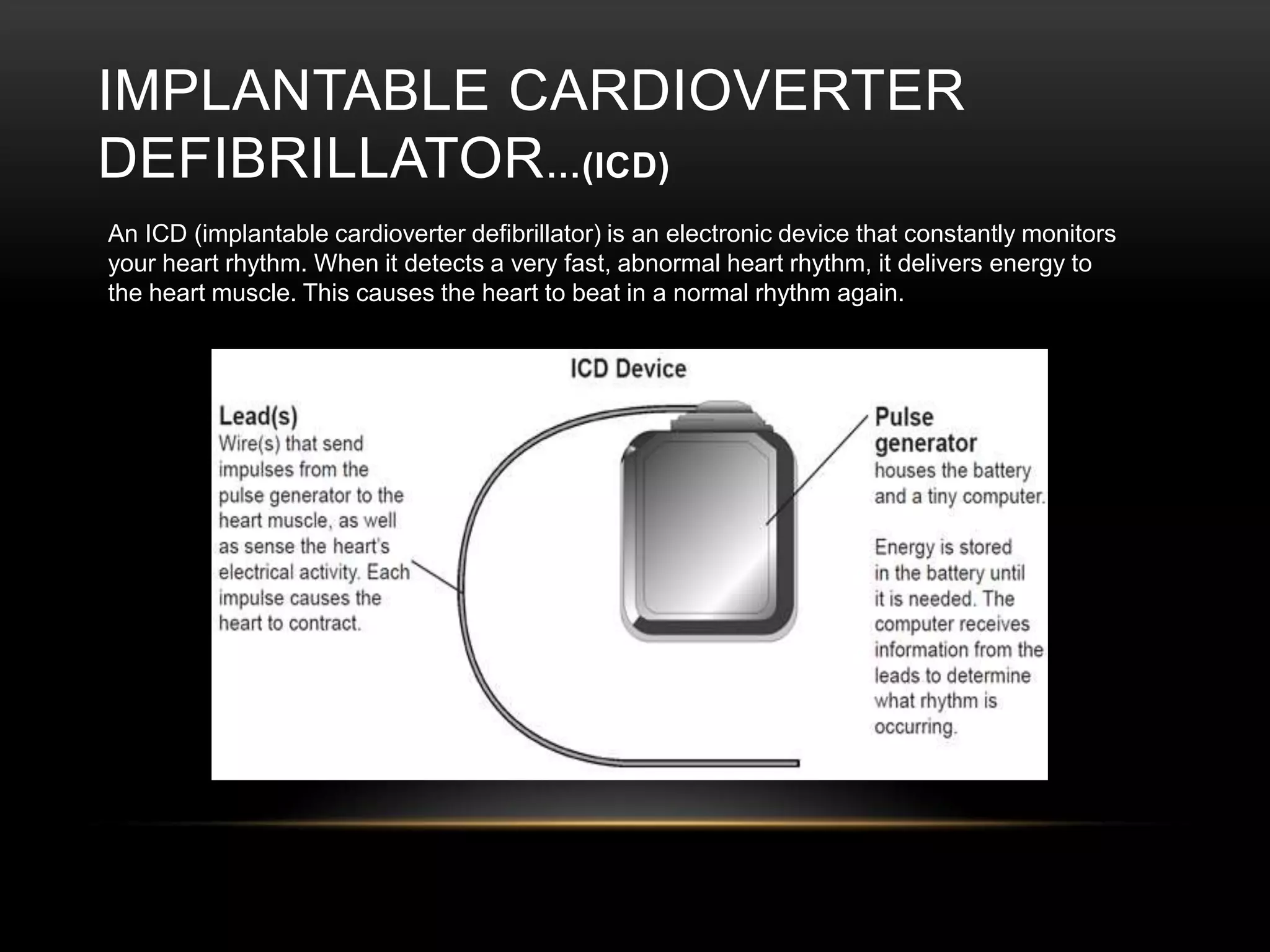 Infections such as rheumatic fever 
