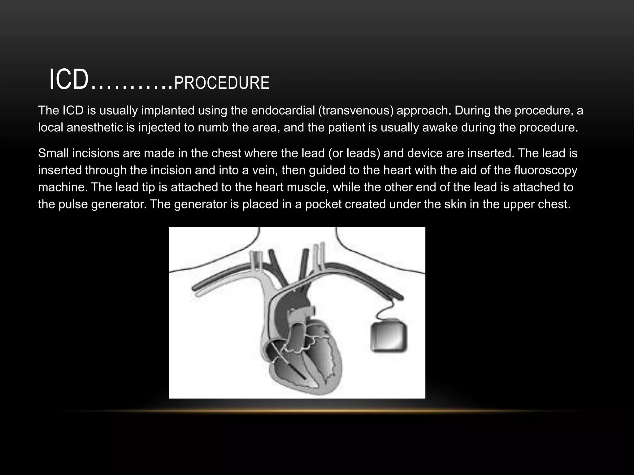 MedicationsProcedure……..Heart valve surgery is open-heart surgery that is done while the patient is under general anesthesia. A cut is made through the breast bone (sternum). The blood is routed away from the heart to a heart-lung bypass machine. This machine keeps the blood circulating while the heart is being operated on.