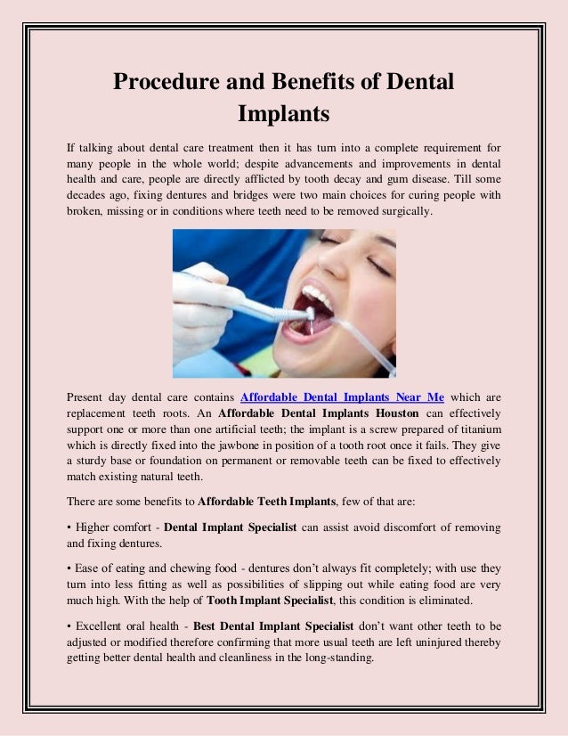 Procedure And Benefits Of Dental Implants
