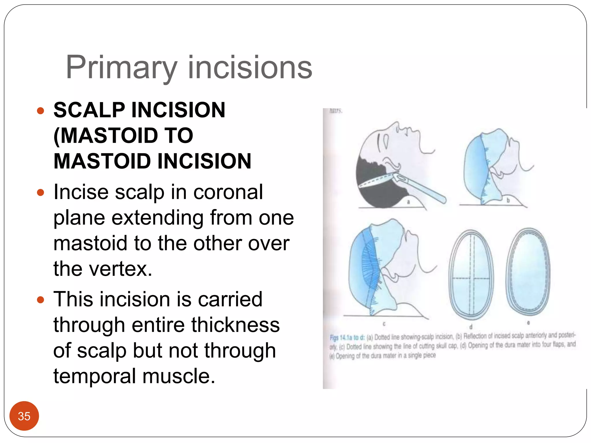 Primary incisions
35
 SCALP INCISION
(MASTOID TO
MASTOID INCISION
 Incise scalp in coronal
plane extending from one
mastoid to the other over
the vertex.
 This incision is carried
through entire thickness
of scalp but not through
temporal muscle.
 