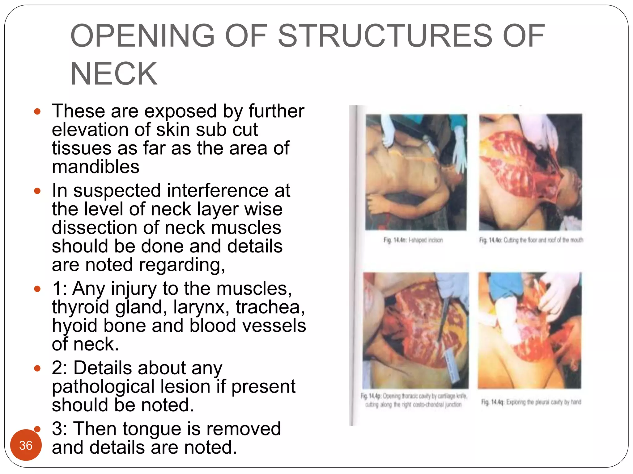 OPENING OF STRUCTURES OF
NECK
36
 These are exposed by further
elevation of skin sub cut
tissues as far as the area of
mandibles
 In suspected interference at
the level of neck layer wise
dissection of neck muscles
should be done and details
are noted regarding,
 1: Any injury to the muscles,
thyroid gland, larynx, trachea,
hyoid bone and blood vessels
of neck.
 2: Details about any
pathological lesion if present
should be noted.
 3: Then tongue is removed
and details are noted.
 