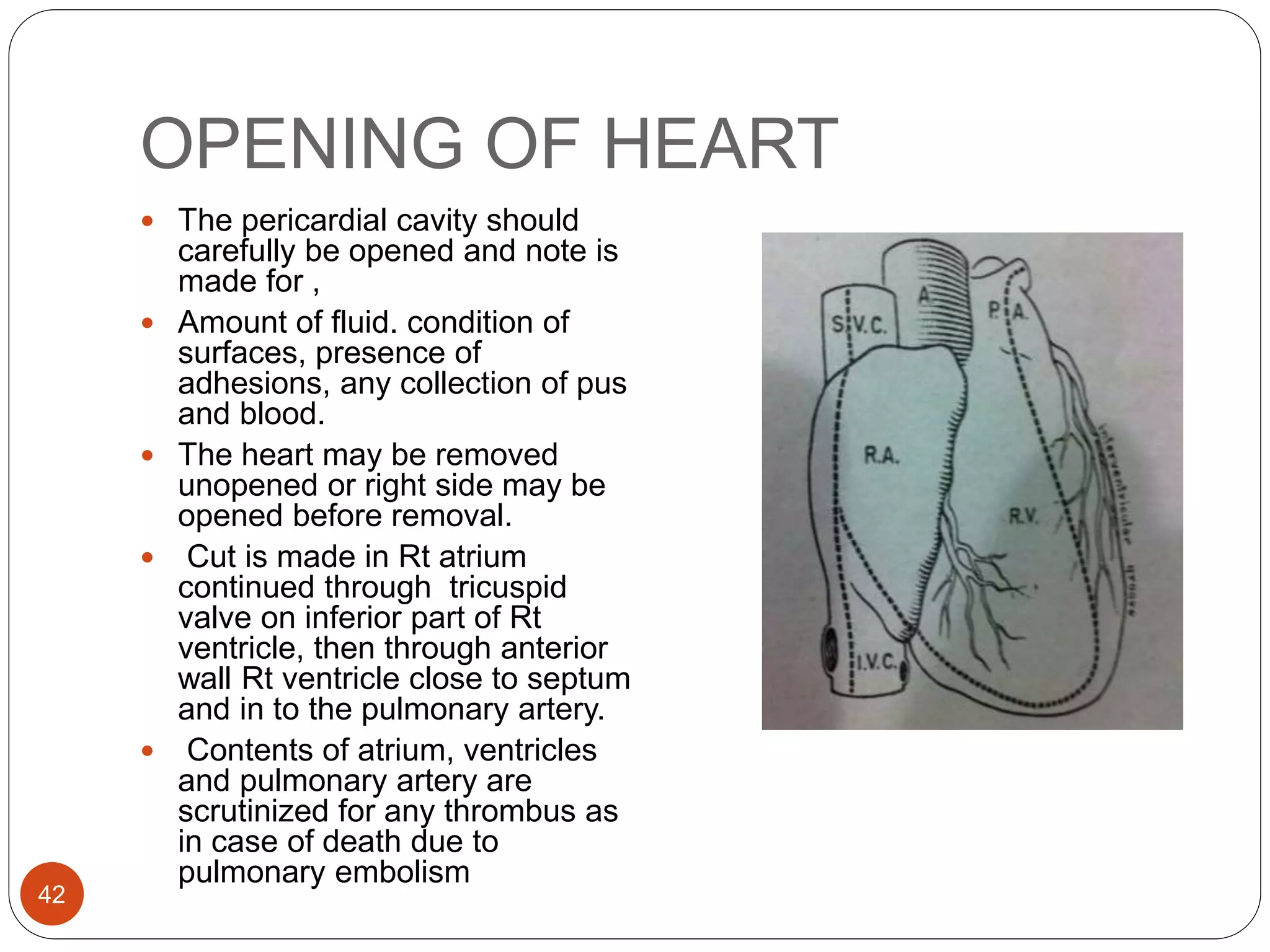 OPENING OF HEART
42
 The pericardial cavity should
carefully be opened and note is
made for ,
 Amount of fluid. condition of
surfaces, presence of
adhesions, any collection of pus
and blood.
 The heart may be removed
unopened or right side may be
opened before removal.
 Cut is made in Rt atrium
continued through tricuspid
valve on inferior part of Rt
ventricle, then through anterior
wall Rt ventricle close to septum
and in to the pulmonary artery.
 Contents of atrium, ventricles
and pulmonary artery are
scrutinized for any thrombus as
in case of death due to
pulmonary embolism
 