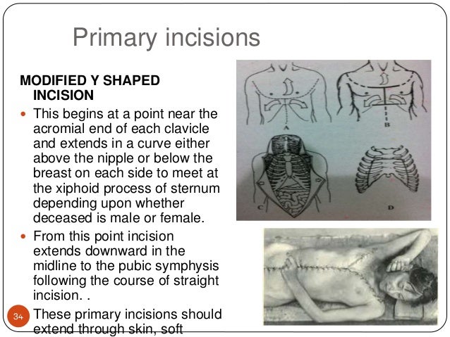 Procedure of autopsy