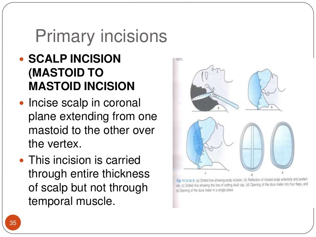 Procedure of autopsy