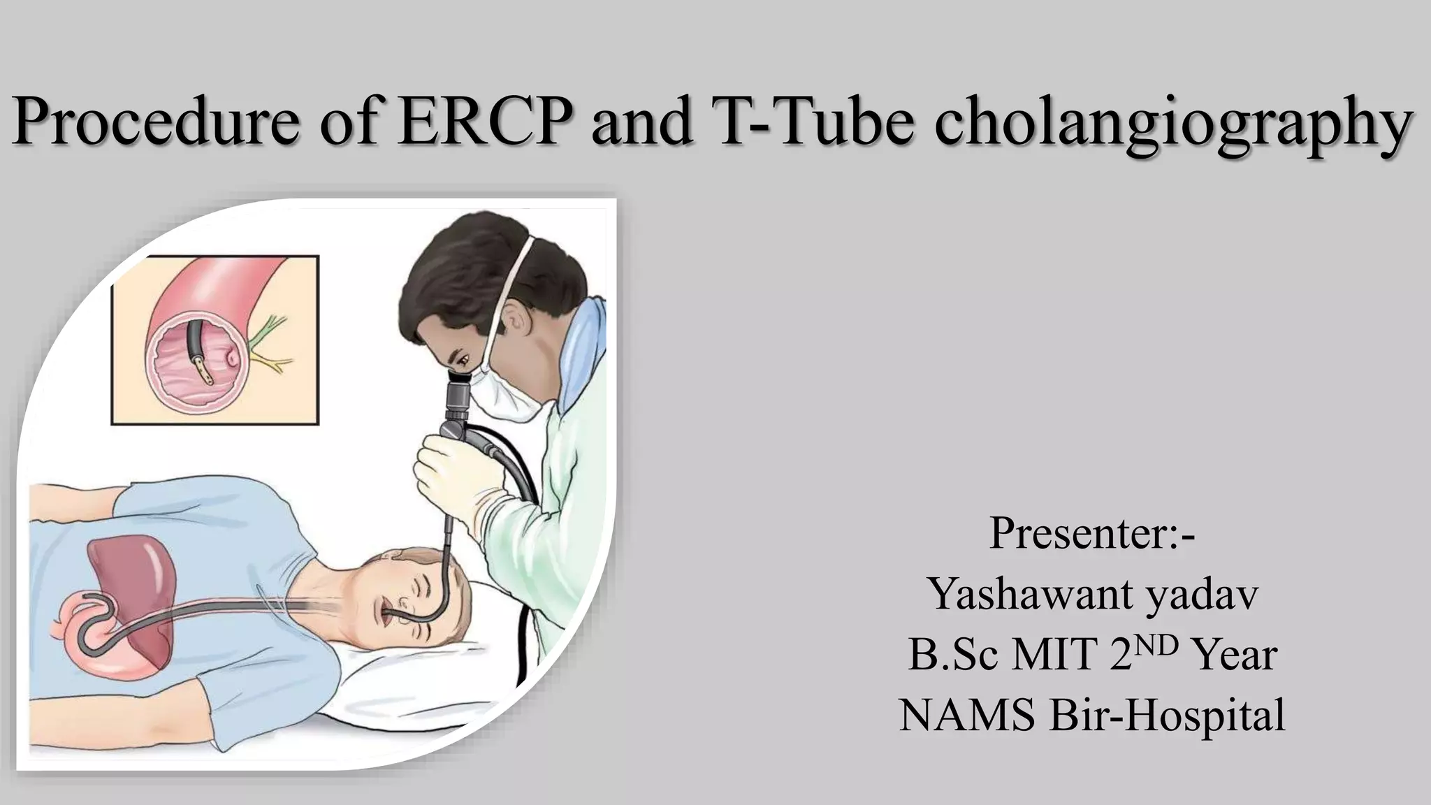 Procedure of ercp and t tube cholangiography | PPTX