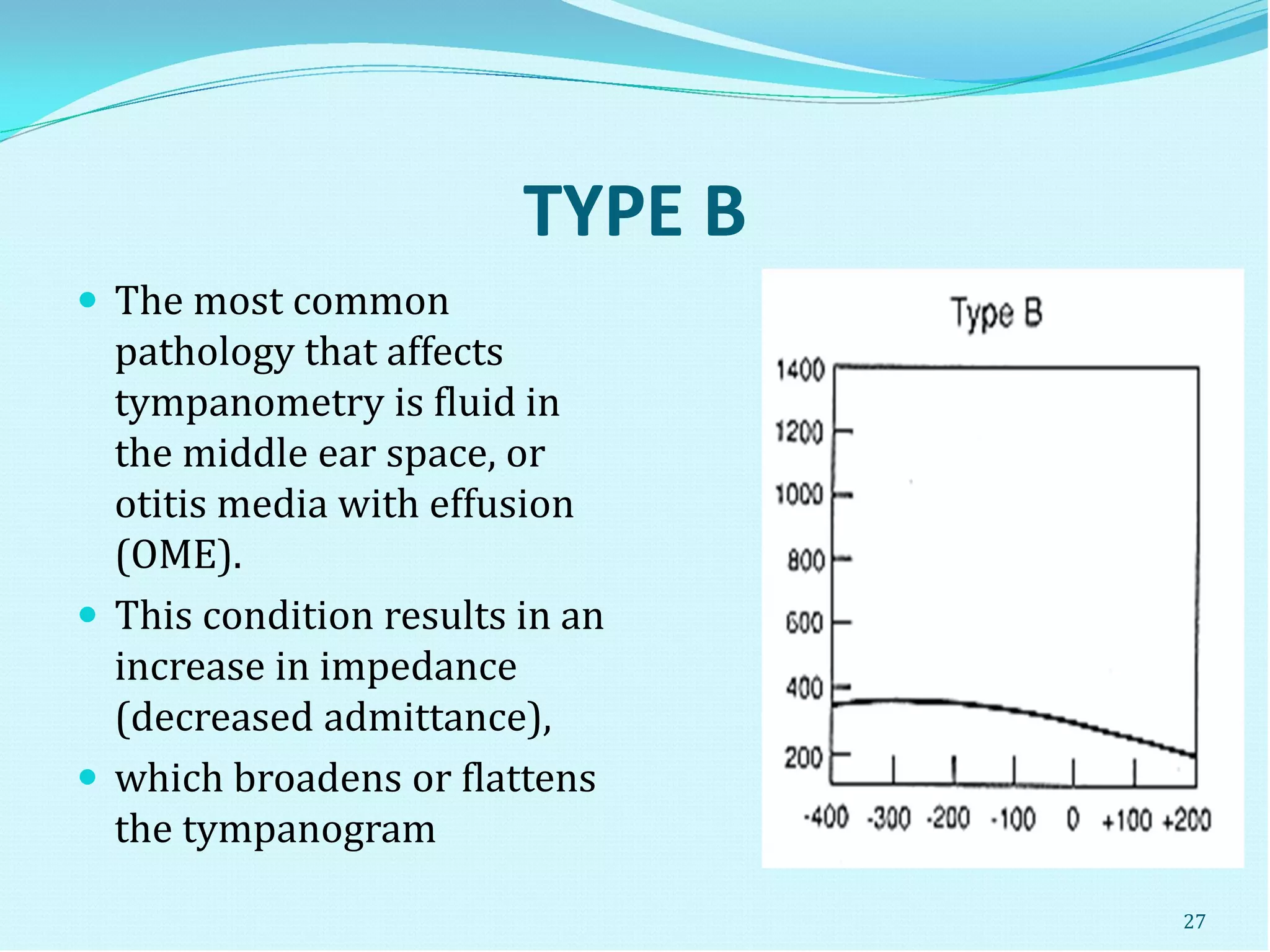 TYPE B
 The most common
pathology that affects
tympanometry is fluid in
the middle ear space, or
otitis media with effusion
(OME).
 This condition results in an
increase in impedance
(decreased admittance),
 which broadens or flattens
the tympanogram
27
 