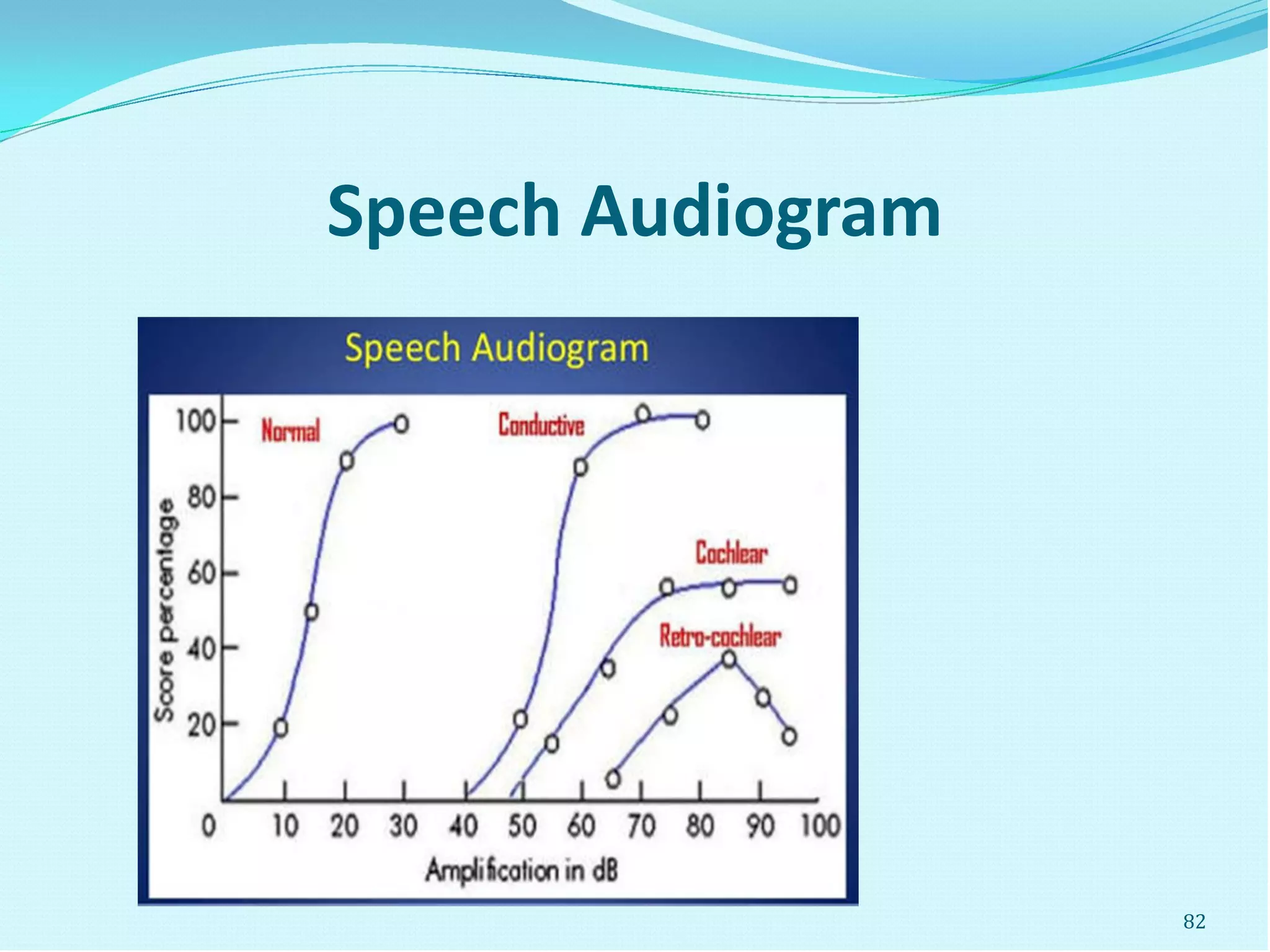 Speech Audiogram
82
 
