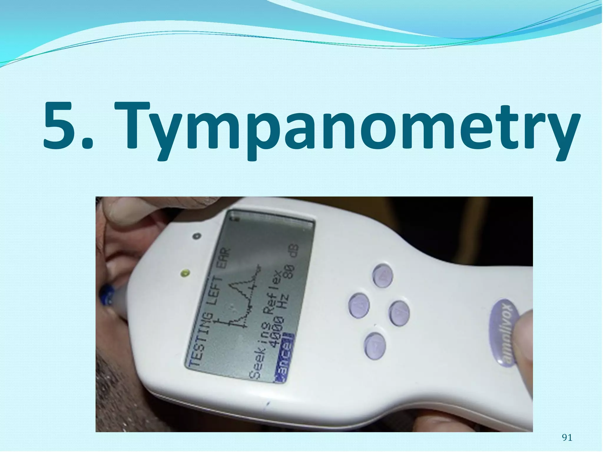 5. Tympanometry
91
 