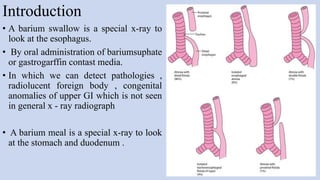 Introduction
• A barium swallow is a special x-ray to
look at the esophagus.
• By oral administration of bariumsuphate
or gastrogarffin contast media.
• In which we can detect pathologies ,
radiolucent foreign body , congenital
anomalies of upper GI which is not seen
in general x - ray radiograph
• A barium meal is a special x-ray to look
at the stomach and duodenum .
3
 