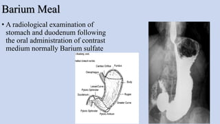 Barium Meal
• A radiological examination of
stomach and duodenum following
the oral administration of contrast
medium normally Barium sulfate
39
 