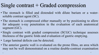 Single contrast + Graded compression
• The stomach is filled and distended with dilute barium or a water-
soluble contrast agent (SC).
• The stomach is compressed either manually or by positioning to allow
for adequate x-ray penetration in the evaluation of each anatomical
segment (GC).
• Single contrast with graded compression (SCGC) technique assesses
thickness of the gastric folds and evaluation of gastric emptying.
• Large luminal defects can be detected.
• The anterior gastric wall is evaluated on the prone films, an area which
may not be well demonstrated on a routine double-contrast examination
. 44
 