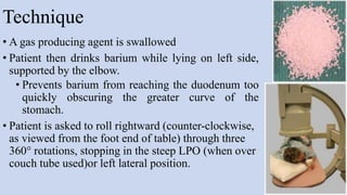 Technique
• A gas producing agent is swallowed
• Patient then drinks barium while lying on left side,
supported by the elbow.
• Prevents barium from reaching the duodenum too
quickly obscuring the greater curve of the
stomach.
• Patient is asked to roll rightward (counter-clockwise,
as viewed from the foot end of table) through three
360° rotations, stopping in the steep LPO (when over
couch tube used)or left lateral position.
56
 