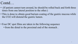Contd…
• (If patient cannot turn around, he should be rolled back and forth three
times from one lateral position to the other.)
• This is done to obtain good barium coating of the gastric mucosa while
the CO2 will distend the gastric lumen.
• Four DC spot films are taken in the following sequence
• from the distal to the proximal end of the stomach .
57
 