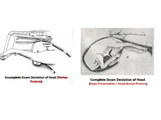 Recent advanes in handling of dystocia
