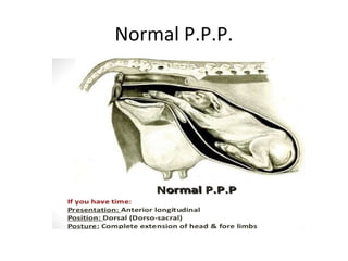 Normal P.P.P.
 