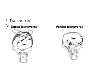 • Transverse:
 Dorso transverse Ventro transverse
 
