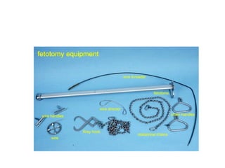 Recent advanes in handling of dystocia