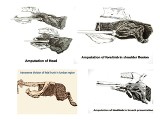 Recent advanes in handling of dystocia