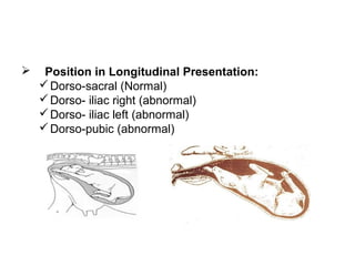 Position in Longitudinal Presentation:
Dorso-sacral (Normal)
Dorso- iliac right (abnormal)
Dorso- iliac left (abnormal)
Dorso-pubic (abnormal)
 