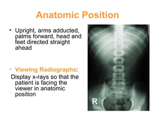 Anatomic Position Upright, arms adducted, palms forward, head and feet directed straight ahead Viewing Radiographs : Display x-rays so that the patient is facing the viewer in anatomic position R 