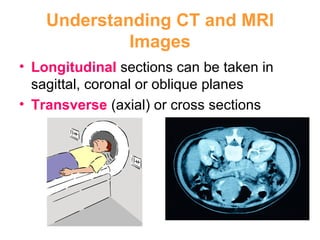 Understanding CT and MRI Images Longitudinal  sections can be taken in sagittal, coronal or oblique planes Transverse  (axial) or cross sections  