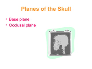 Planes of the Skull Base plane Occlusal plane 