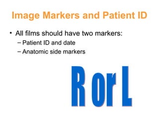 Image Markers and Patient ID All films should have two markers: Patient ID and date Anatomic side markers R or L 
