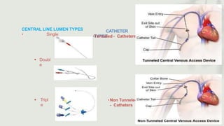 CENTRAL LINE LUMEN TYPES
• Single
 Doubl
e
 Tripl
e
CATHETER
TYPES
•Tunneled - Catheters
•Non Tunneled
- Catheters
 