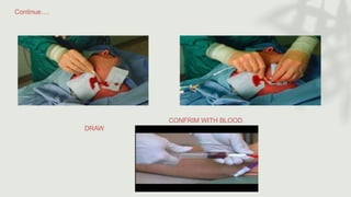 Continue….
CONFRIM WITH BLOOD
DRAW
 