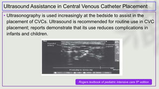 Ultrasound Assistance in Central Venous Catheter Placement
• Ultrasonography is used increasingly at the bedside to assist in the
placement of CVCs. Ultrasound is recommended for routine use in CVC
placement; reports demonstrate that its use reduces complications in
infants and children.
Rogers textbook of pediatric intensive care 5th edition
 