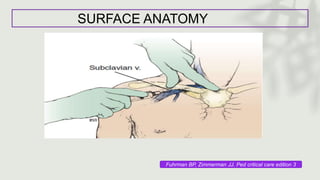 SURFACE ANATOMY
Fuhrman BP, Zimmerman JJ. Ped critical care edition 3
 