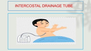 INTERCOSTAL DRAINAGE TUBE
 
