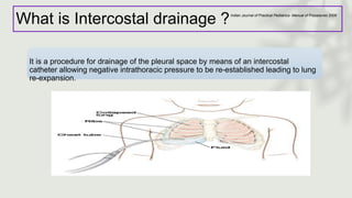 What is Intercostal drainage ?
It is a procedure for drainage of the pleural space by means of an intercostal
catheter allowing negative intrathoracic pressure to be re-established leading to lung
re-expansion.
Indian Journal of Practical Pediatrics- Manual of Procedures 2008
 