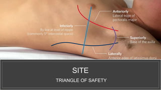 SITE
TRIANGLE OF SAFETY
 