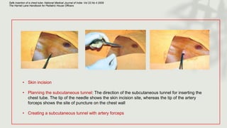 Safe insertion of a chest tube- National Medical Journal of India- Vol 22.No 4 2009
The Harriet Lane Handbook for Pediatric House Officers
• Skin incision
• Planning the subcutaneous tunnel: The direction of the subcutaneous tunnel for inserting the
chest tube. The tip of the needle shows the skin incision site, whereas the tip of the artery
forceps shows the site of puncture on the chest wall
• Creating a subcutaneous tunnel with artery forceps
 