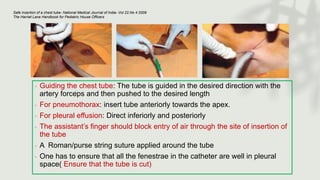 ◦ Guiding the chest tube: The tube is guided in the desired direction with the
artery forceps and then pushed to the desired length
◦ For pneumothorax: insert tube anteriorly towards the apex.
◦ For pleural effusion: Direct inferiorly and posteriorly
◦ The assistant’s finger should block entry of air through the site of insertion of
the tube
◦ A Roman/purse string suture applied around the tube
◦ One has to ensure that all the fenestrae in the catheter are well in pleural
space( Ensure that the tube is cut)
Safe insertion of a chest tube- National Medical Journal of India- Vol 22.No 4 2009
The Harriet Lane Handbook for Pediatric House Officers
 