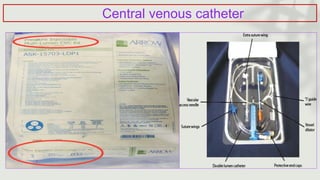 Central venous catheter
 