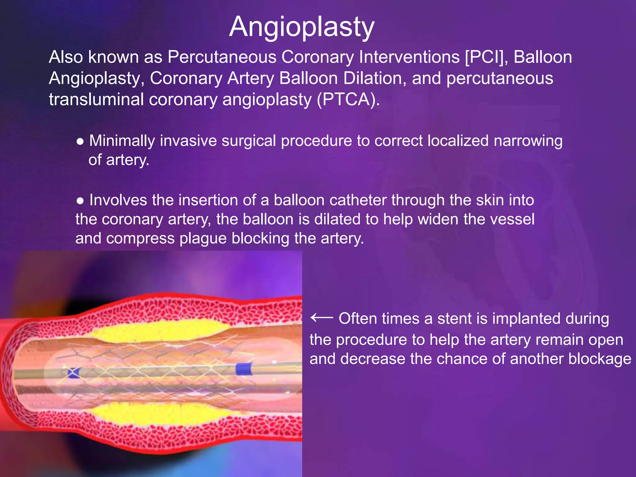 Angioplasty
Also known as Percutaneous Coronary Interventions [PCI], Balloon
Angioplasty, Coronary Artery Balloon Dilation, and percutaneous
transluminal coronary angioplasty (PTCA).

   ● Minimally invasive surgical procedure to correct localized narrowing
     of artery.

   ● Involves the insertion of a balloon catheter through the skin into
   the coronary artery, the balloon is dilated to help widen the vessel
   and compress plague blocking the artery.




                                     ← Often times a stent is implanted during
                                     the procedure to help the artery remain open
                                     and decrease the chance of another blockage
 
