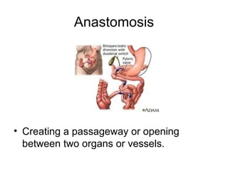 Anastomosis




• Creating a passageway or opening
  between two organs or vessels.
 