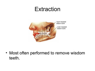 Extraction




• Most often performed to remove wisdom
  teeth.
 